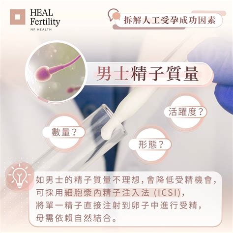 可靠的人工受孕价钱