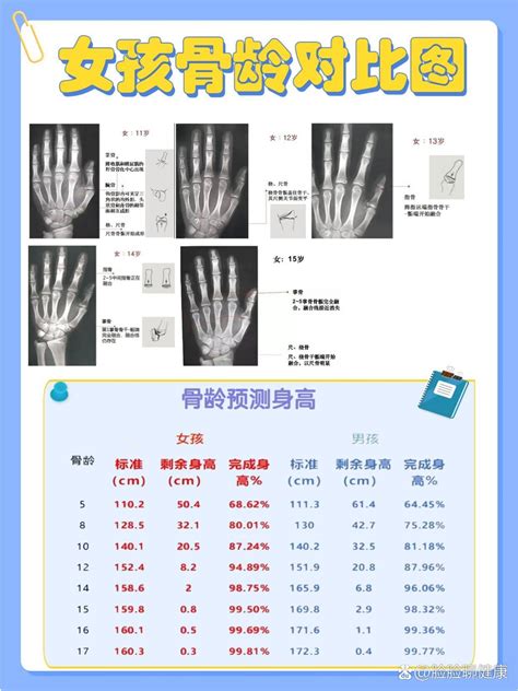 小孩到医院看骨龄可靠吗