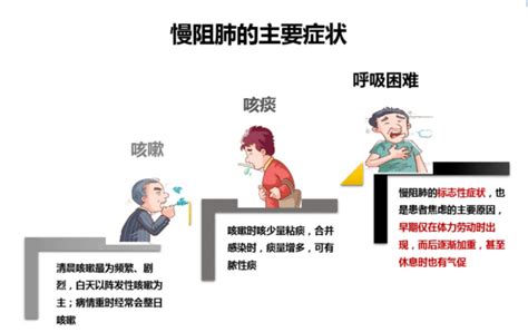 慢性阻肺安全吗