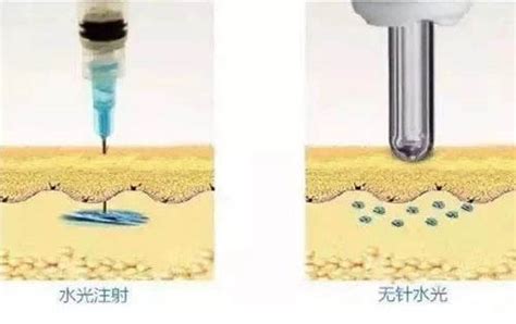 无针水光50一次可靠吗