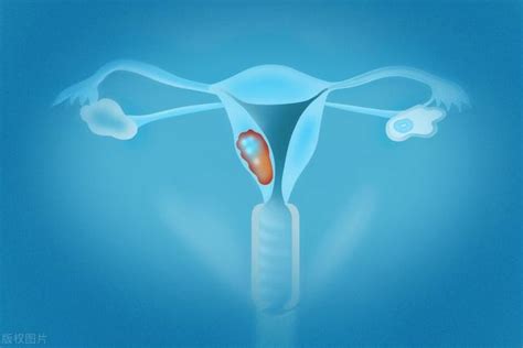 私密紧缩术安全吗