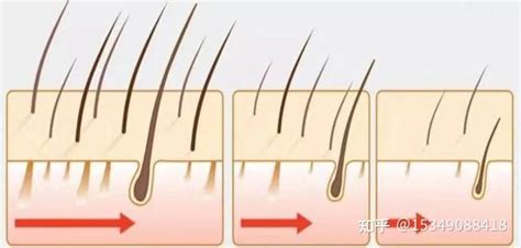 种植毛发可信吗